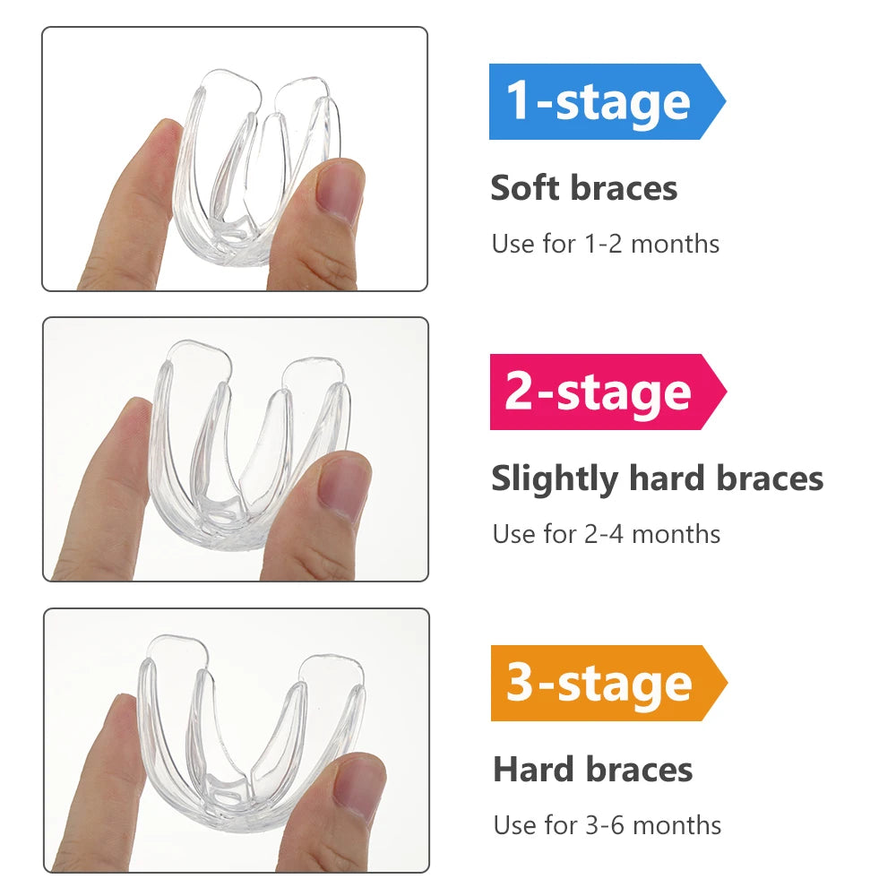 3-Stage Kids Dental Orthodontic Alignment Trainer Set - 4