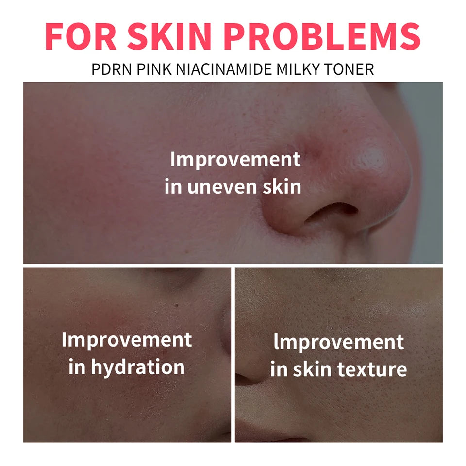 PDRN Niacinamide Hydrating Milky Facial Toner - 8