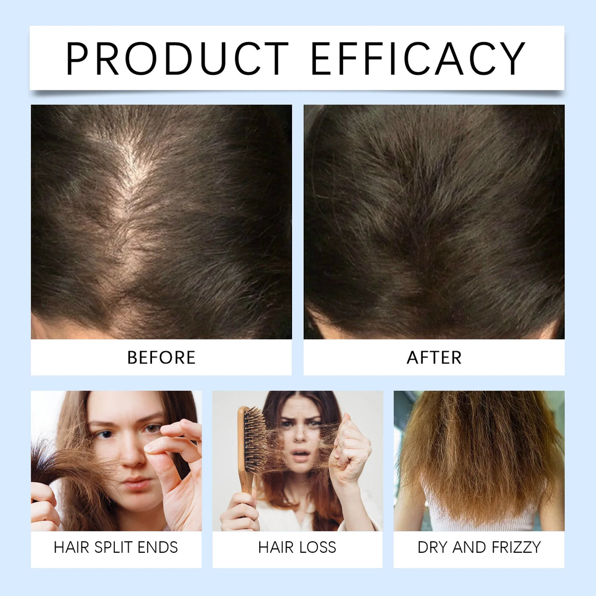 Rosemary Scalp Nourishing Hair Growth Serum Roller