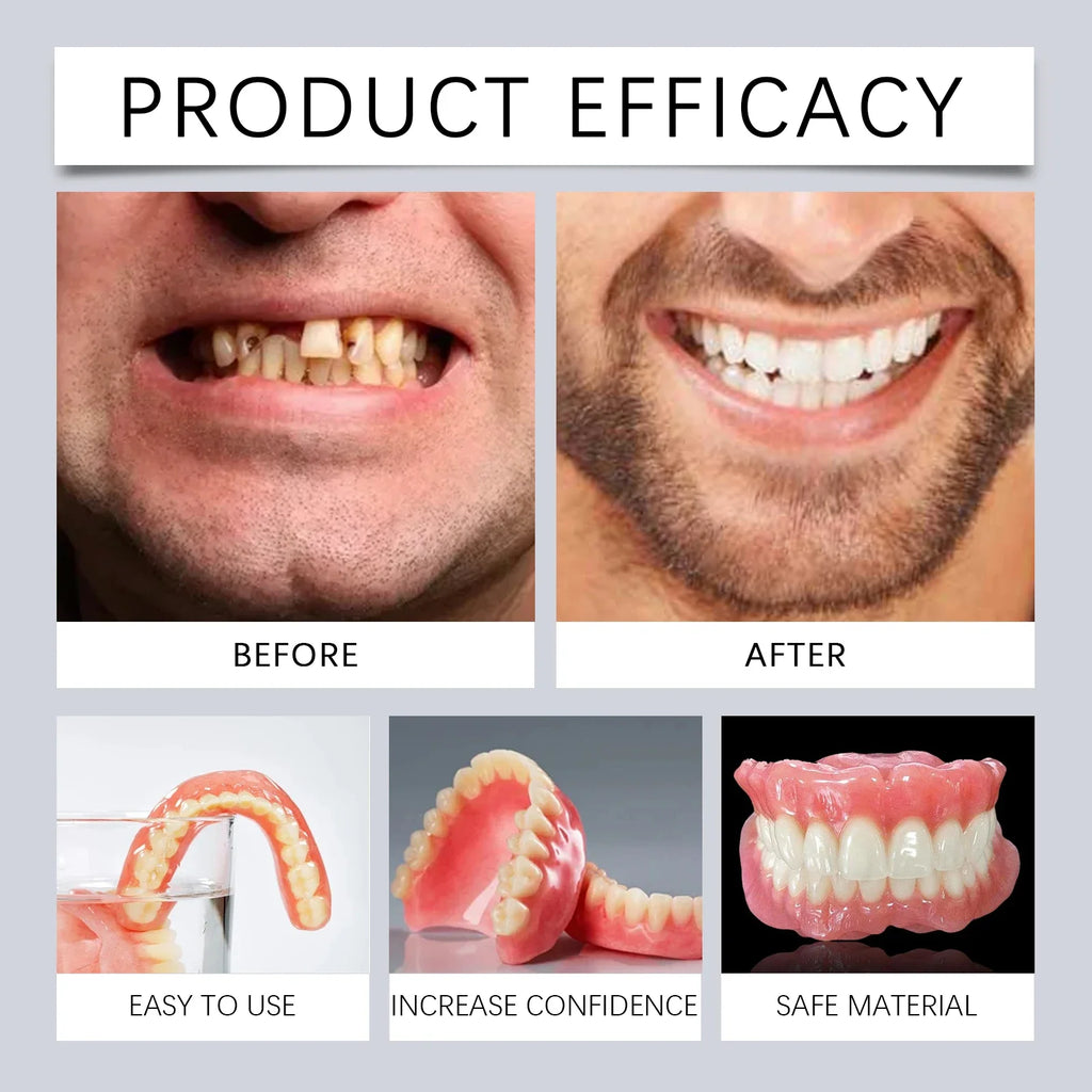 Instant Smile Cosmetic Denture Fitting Kit for Natural Teeth Alignment