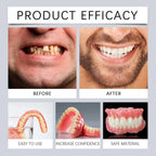 Instant Smile Cosmetic Denture Fitting Kit for Natural Teeth Alignment
