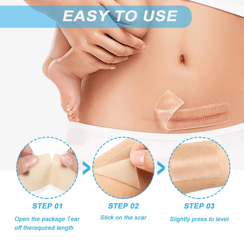 Reusable Silicone Gel Scar Removal Tape Roll