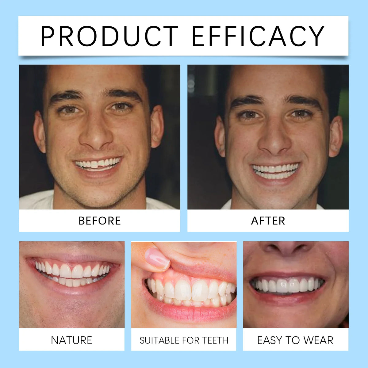 Comfortable Silicone Denture Set for Natural Smile Restoration