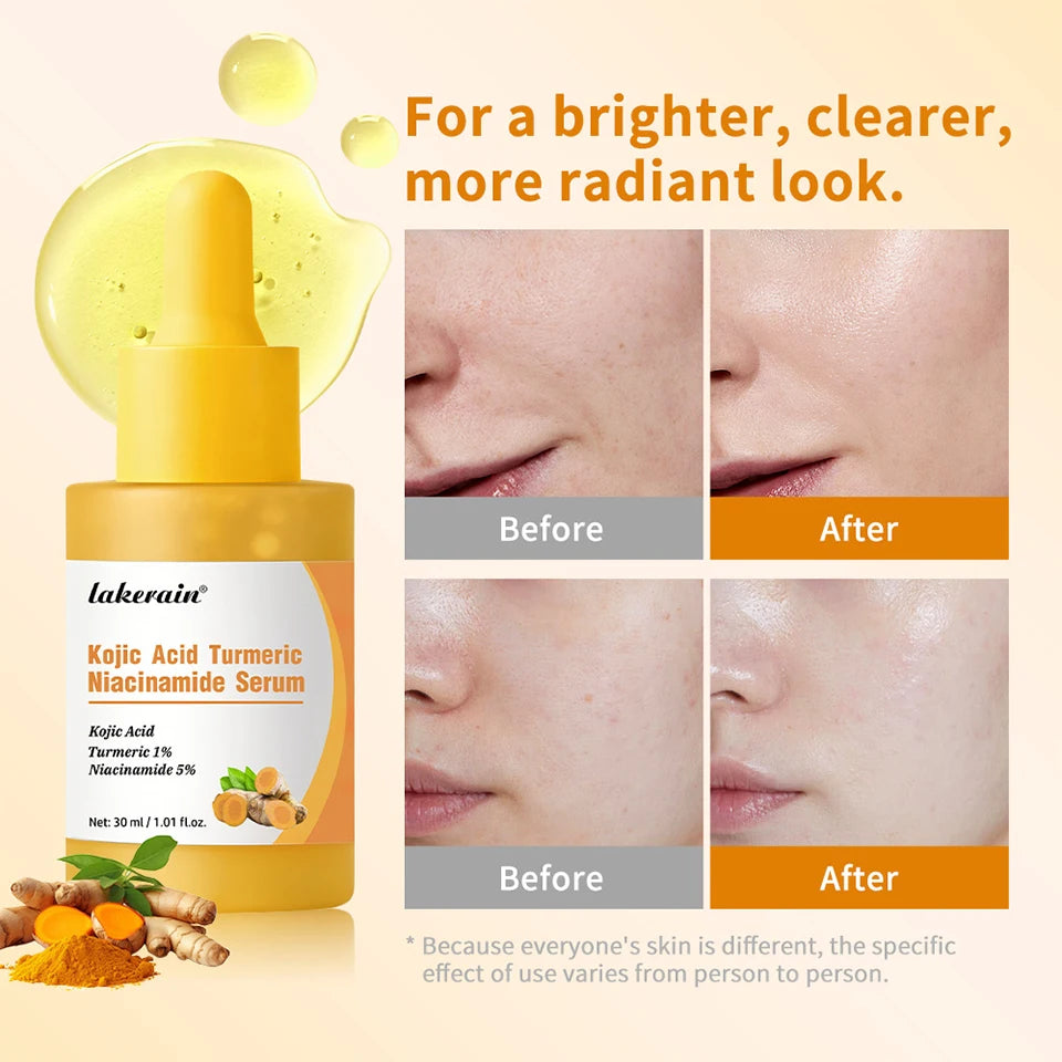 Kojic Acid and Turmeric Brightening Face Serum