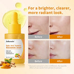 Kojic Acid and Turmeric Brightening Face Serum