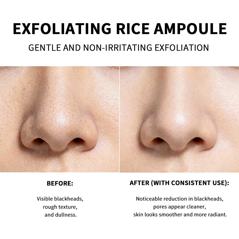 Rice Exfoliating Peeling Essence for Deep Pore Cleansing - 5