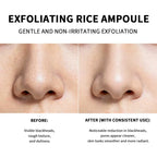 Rice Exfoliating Peeling Essence for Deep Pore Cleansing