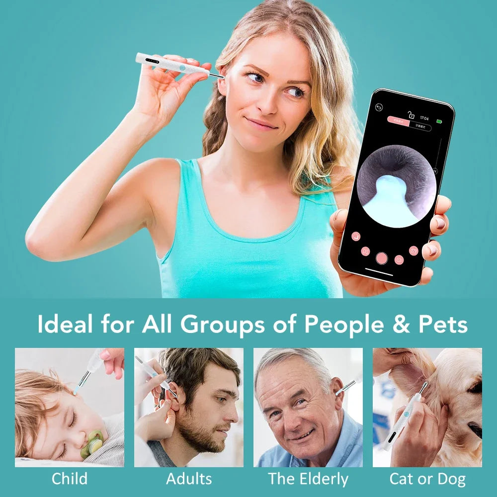 Visual Ear Wax Cleaner with HD Camera and Tweezers - 6