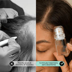 Microneedle Scalp Serum Kit for Hair Regrowth and Follicle Repair