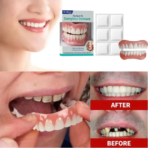 Instant Cosmetic Teeth Veneers for Natural Smile Enhancement