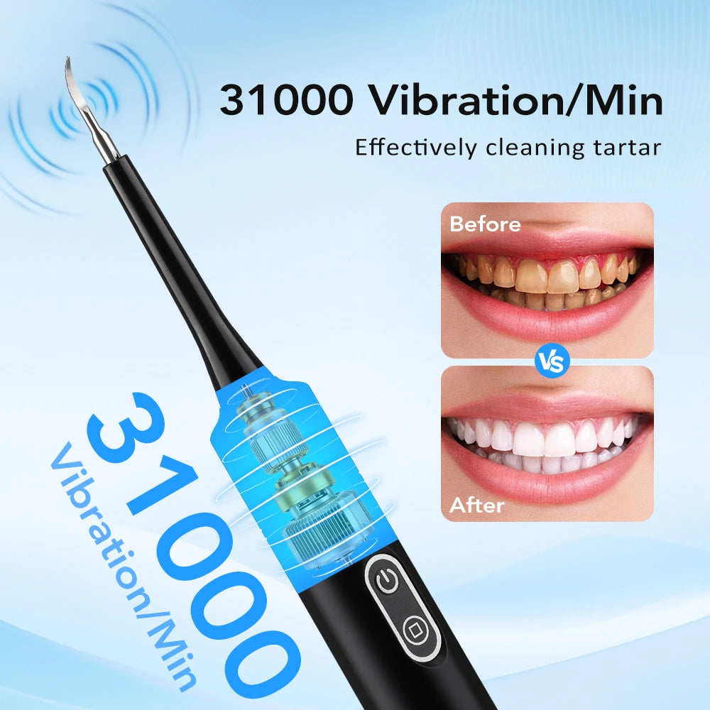 Electric Sonic Teeth Cleaner and Plaque Remover