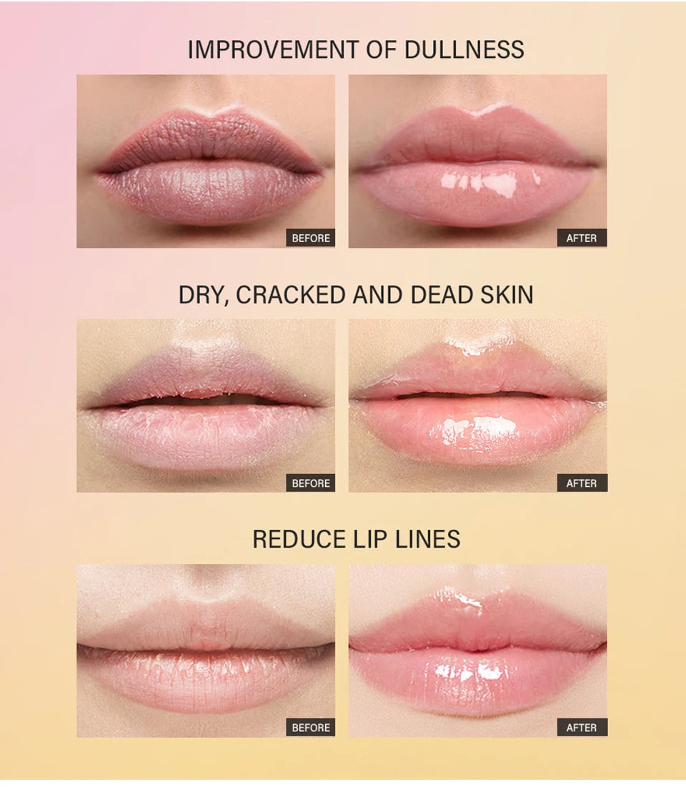 Peptide Moisturizing Lip Treatment Gel