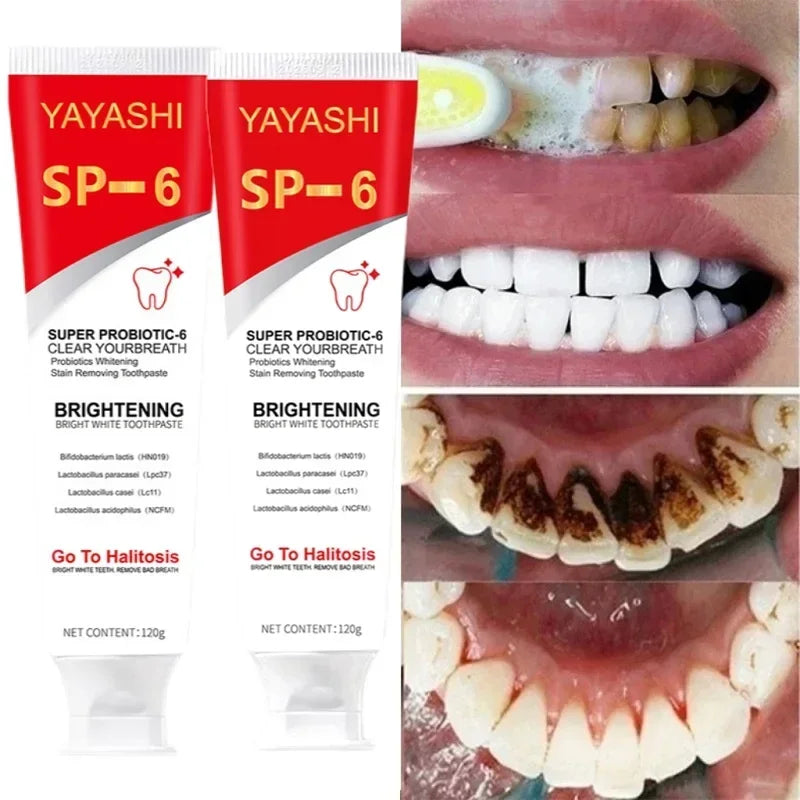 Probiotic Teeth Whitening Toothpaste for Stain Removal and Fresh Breath - 1