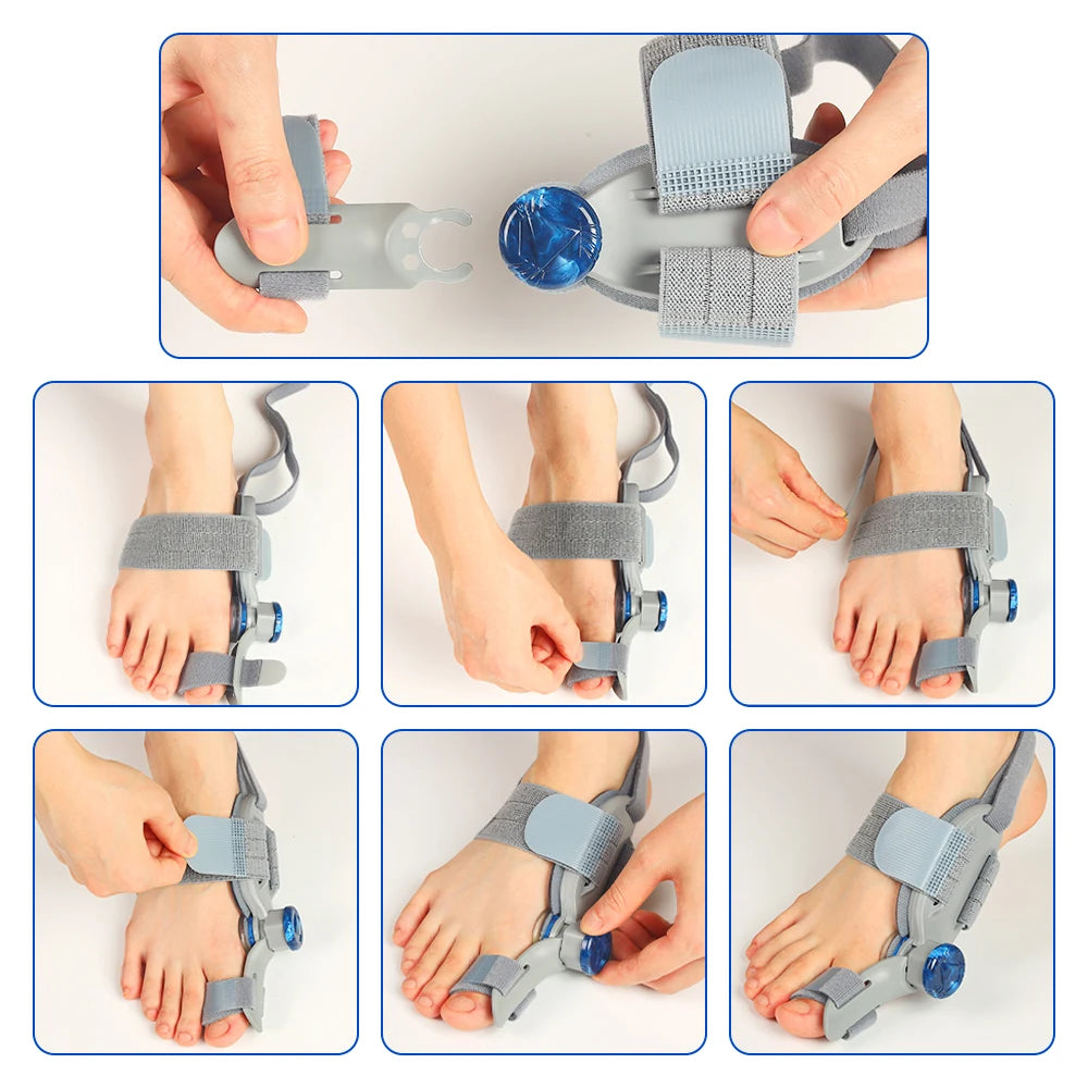 Adjustable Bunion Corrector and Big Toe Straightener