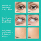 Stainless Steel Cooling Facial Globes for Puffiness and Wrinkles
