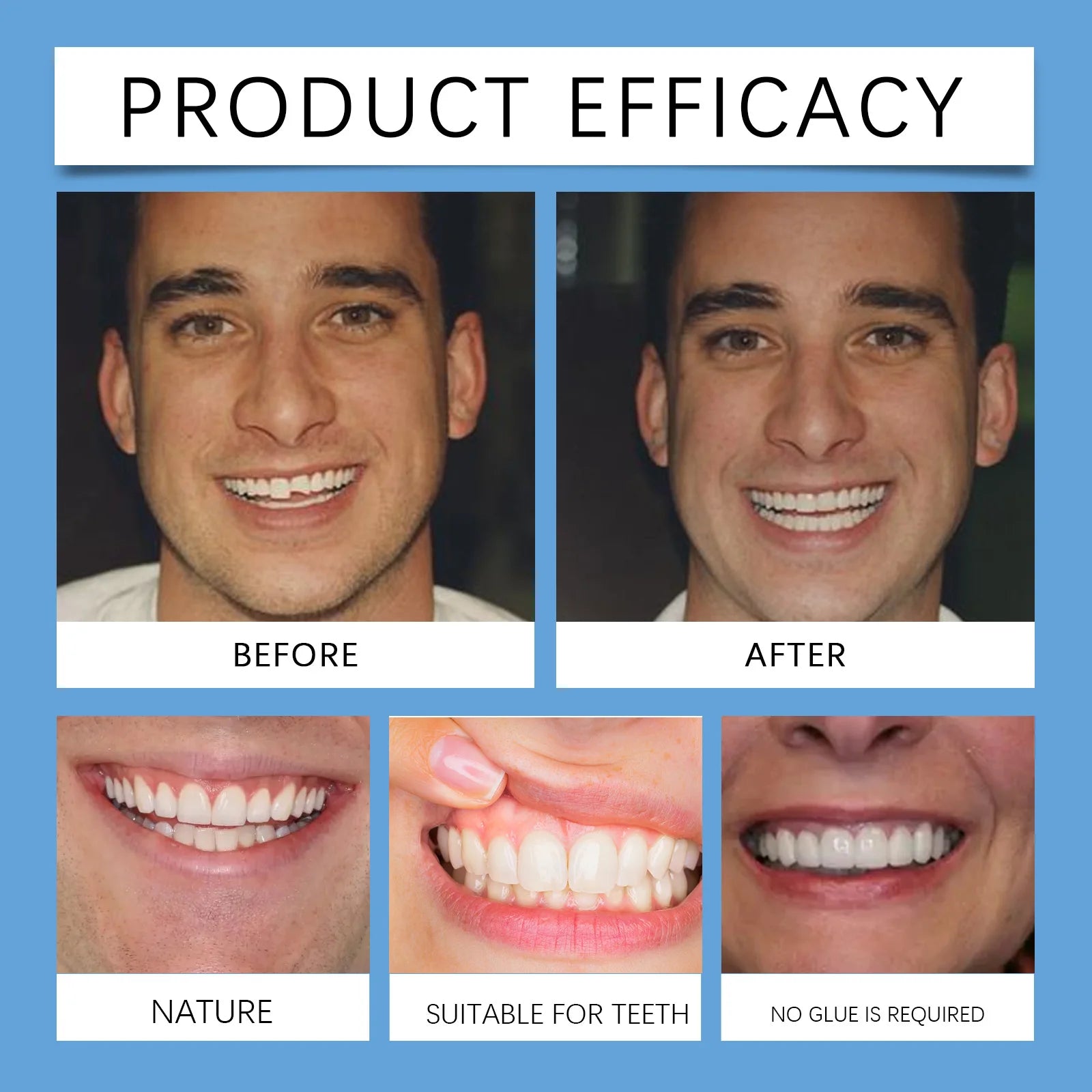 Adjustable Snap-On Dentures for Instant Smile Repair - 18
