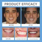 Adjustable Snap-On Dentures for Instant Smile Repair