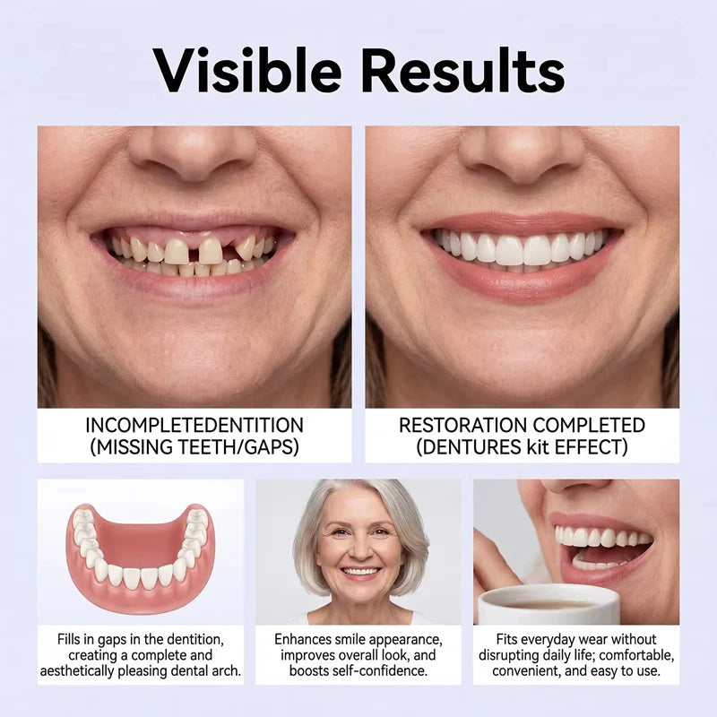 Comfortable Full Set Silicone Dentures for Instant Smile Enhancement