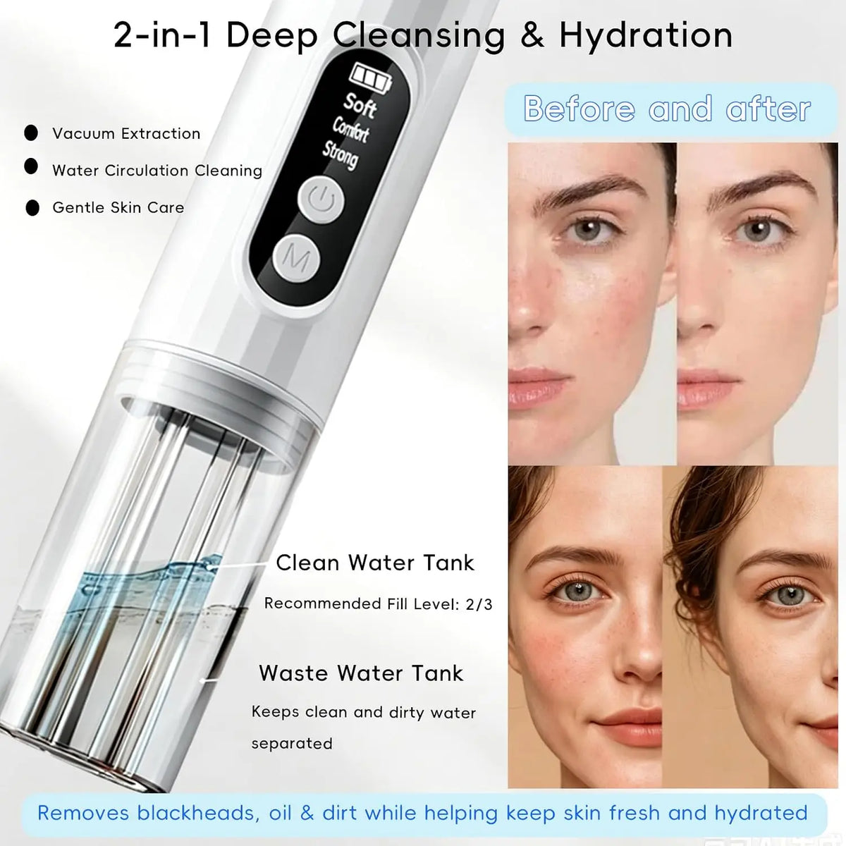 Electric Pore Vacuum and Blackhead Remover with Hydration System