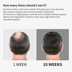 Microneedle Hair Regrowth and Scalp Nourishing Treatment Kit
