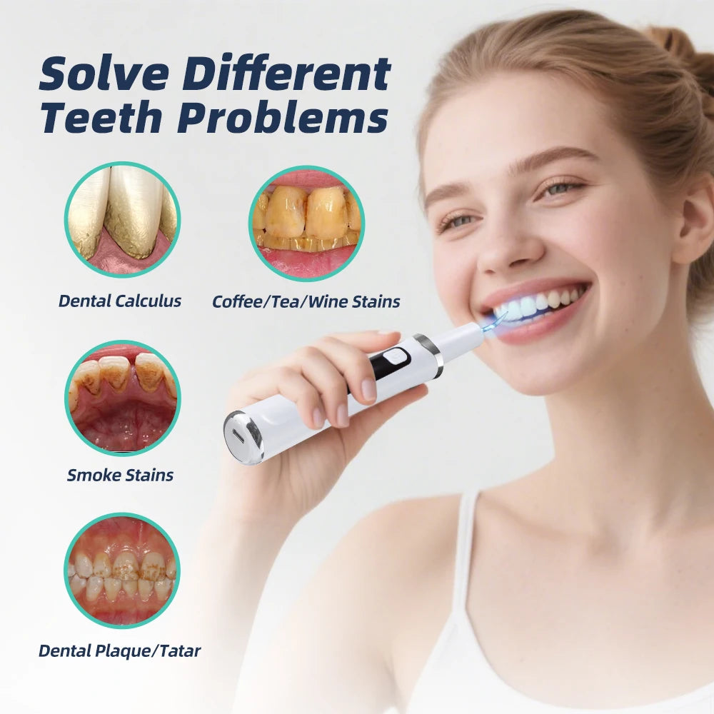 Ultrasonic Electric Teeth Cleaner and Tartar Remover