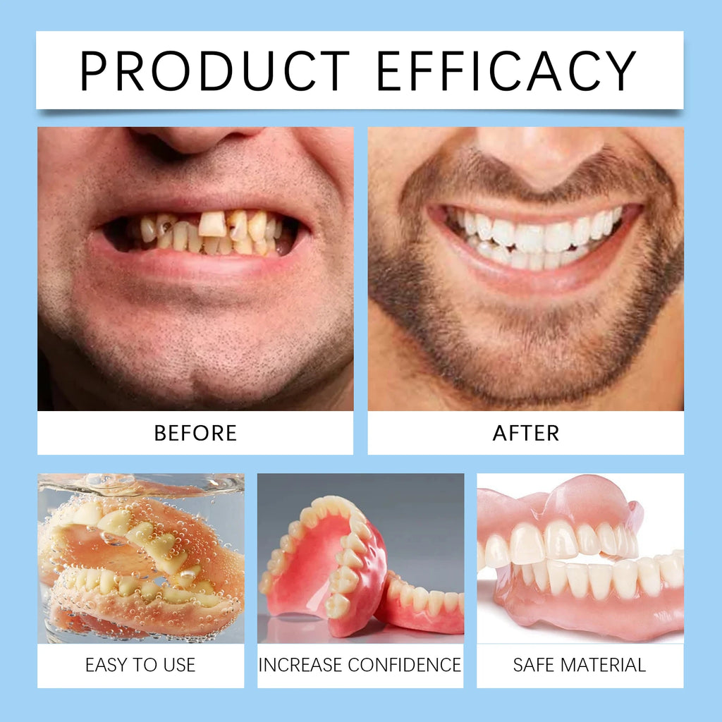 Temporary Silicone Snap-On Whitening Dentures for Upper and Lower Teeth