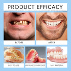 Temporary Silicone Smile Veneers for Upper and Lower Teeth