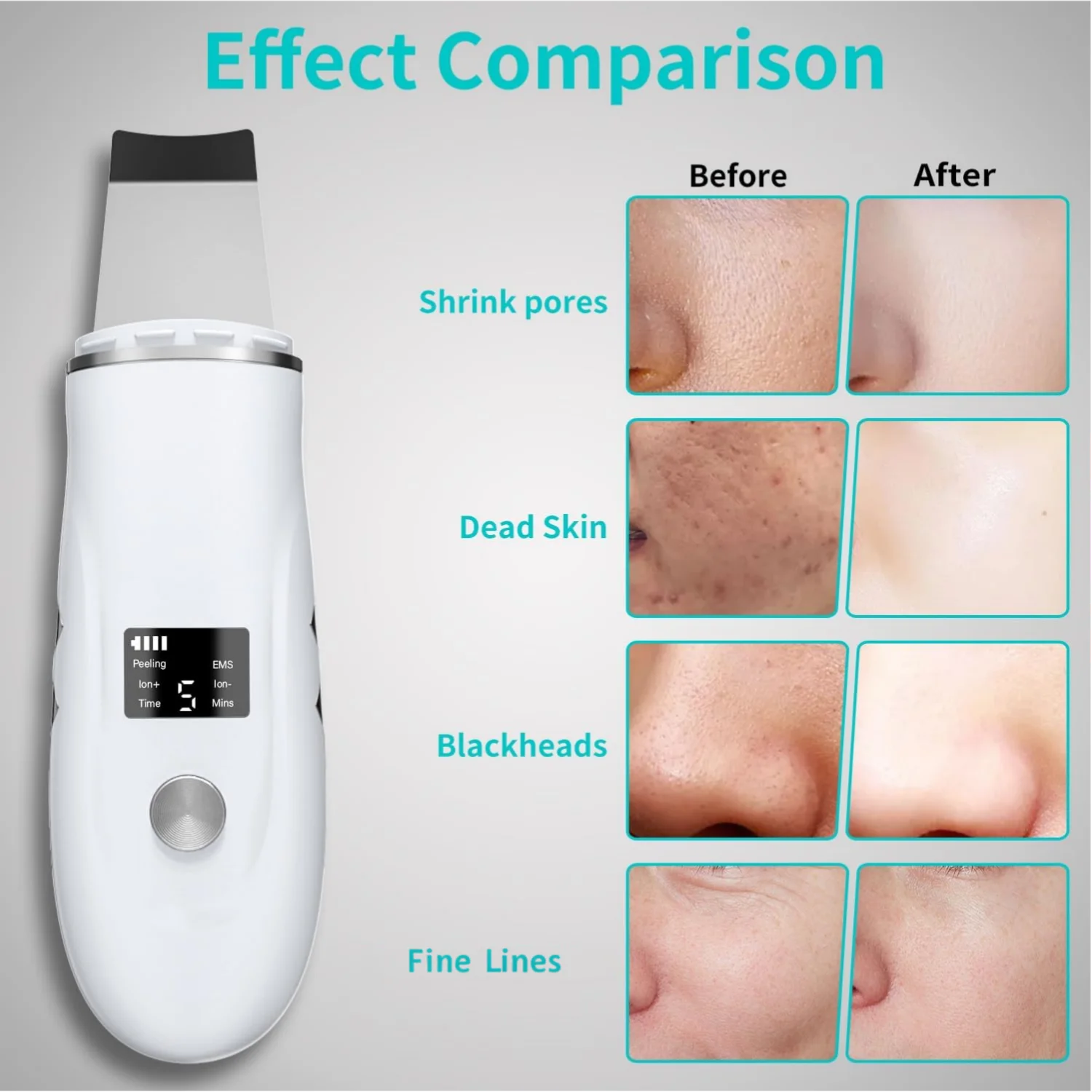 4-in-1 Ultrasonic Facial Skin Scrubber and Blackhead Remover - 3