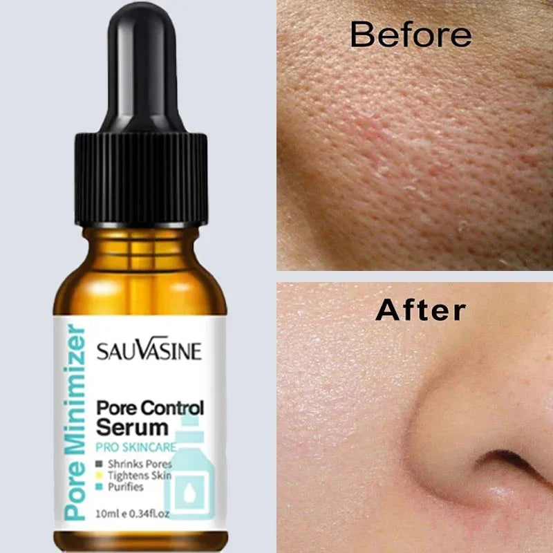 Pore Minimizing Facial Tightening Serum - 1