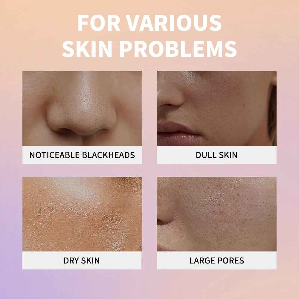 Rice Exfoliating Peeling Essence for Deep Pore Cleansing - 6