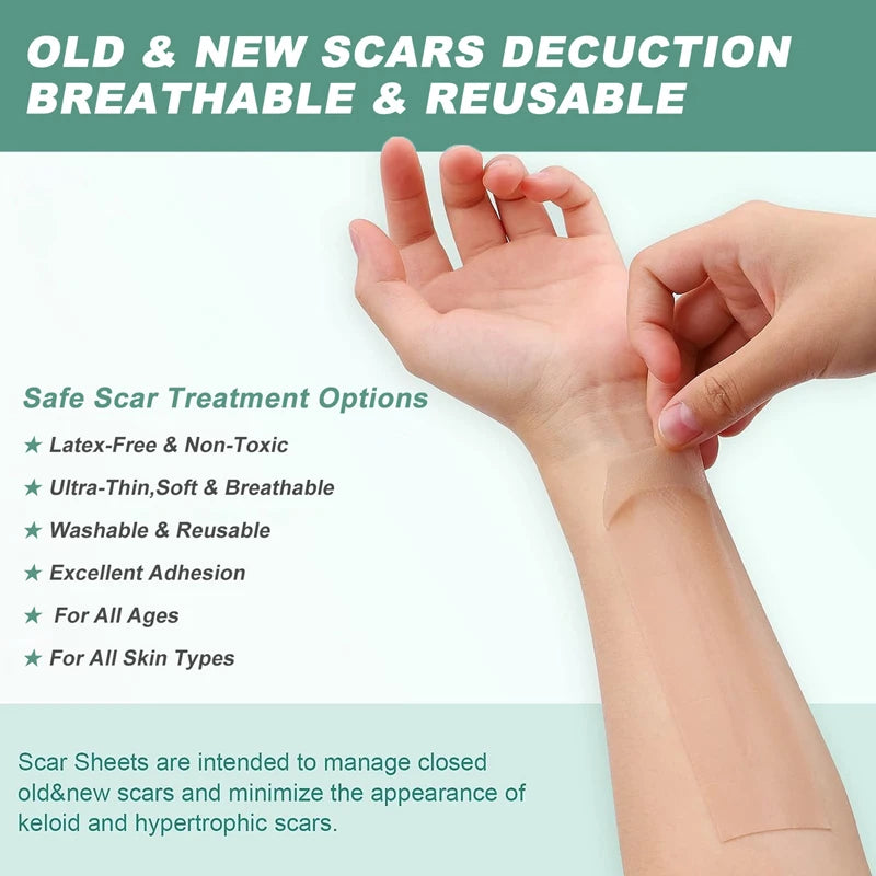 Reusable Silicone Gel Scar Removal Tape Roll - 4