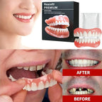 Instant Cosmetic Dentures for Upper and Lower Teeth