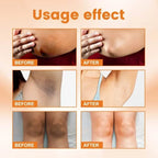 Vitamin C Brightening Cream for Dark Spots and Underarms