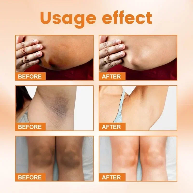 Vitamin C Brightening Cream for Dark Spots and Underarms