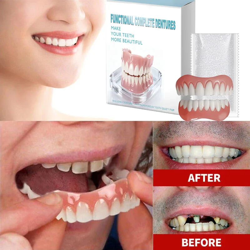 Comfortable Snap-On Silicone Cosmetic Teeth Veneers Set