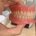 Comfortable Snap-On Veneer Dentures for Instant Smile Makeover