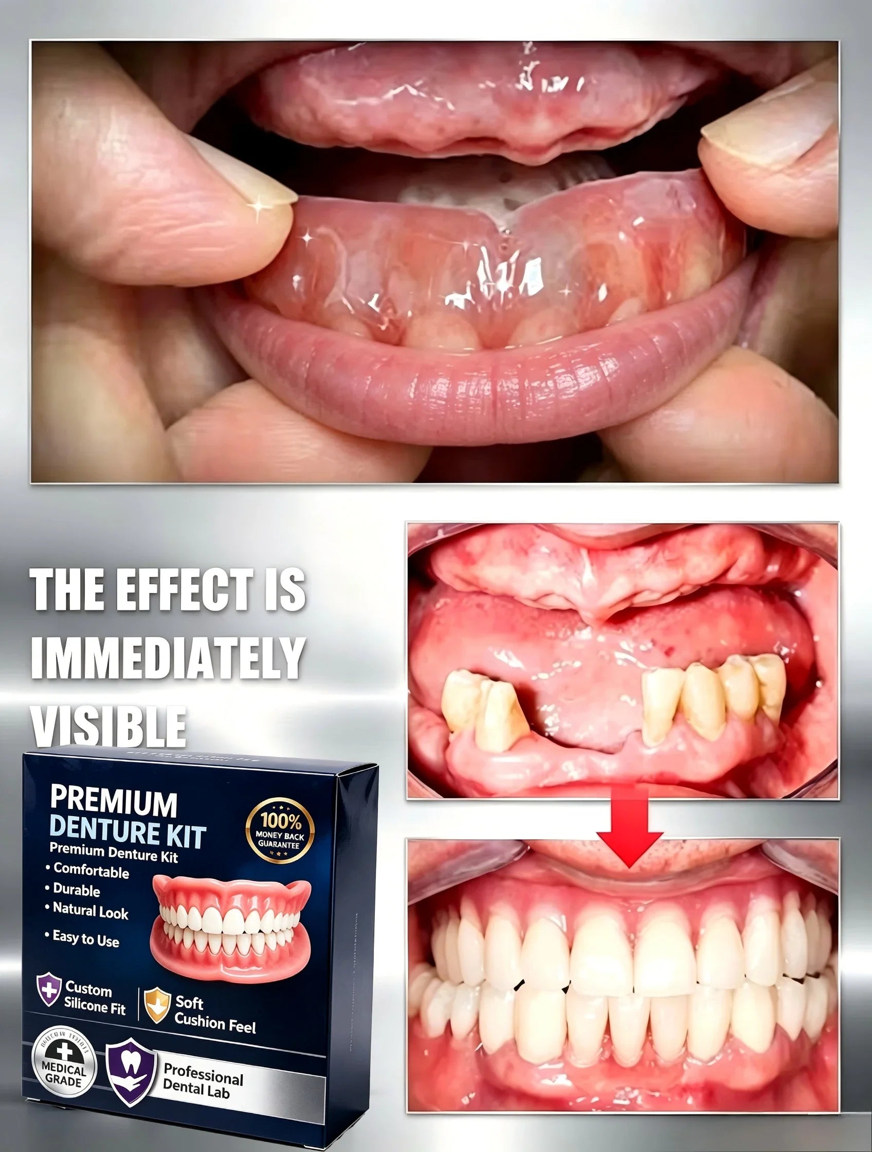Temporary Silicone Cosmetic Denture Kit for Natural Smile - 3