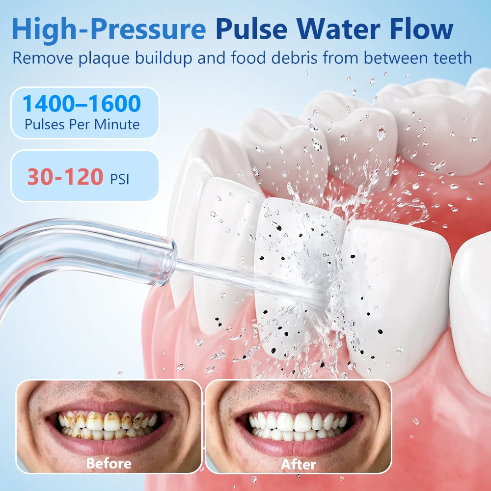 Portable Cordless Water Flosser for Teeth and Braces