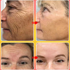 Anti-Wrinkle Lifting and Firming Face Cream