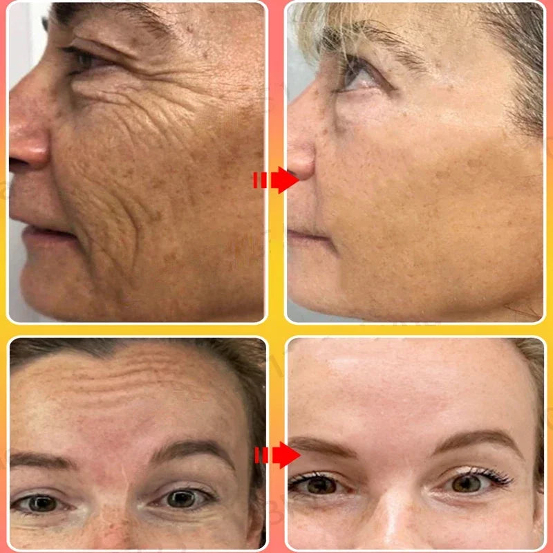 Anti-Wrinkle Lifting and Firming Face Cream