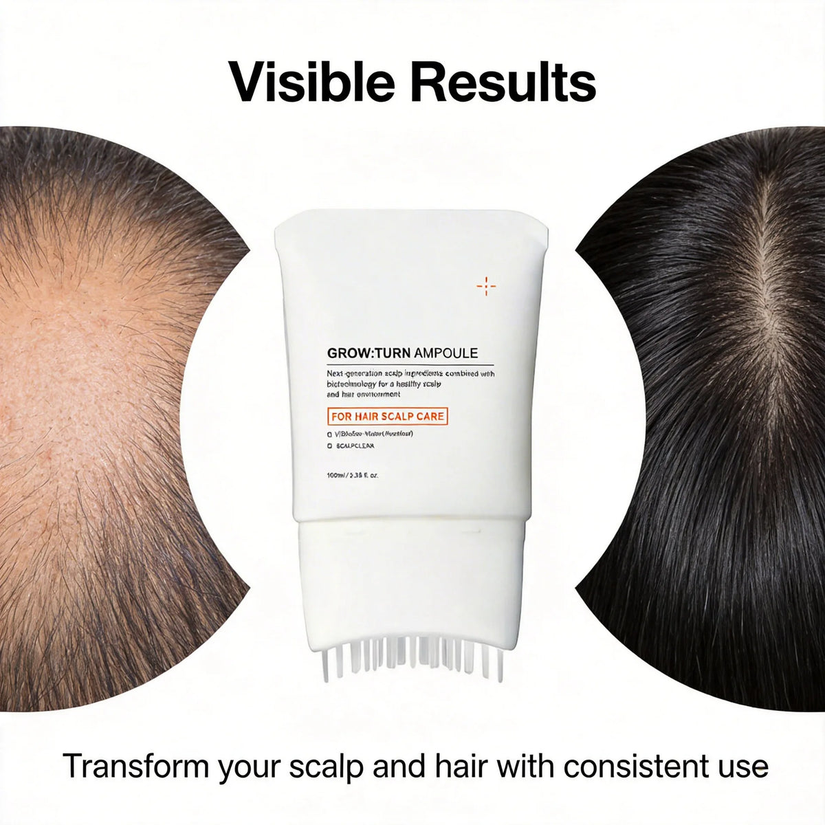 Scalp Nourishing Hair Growth Serum with Integrated Massager