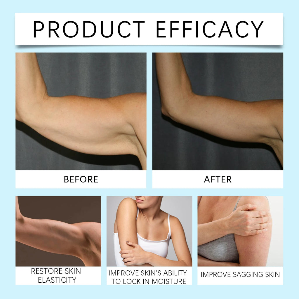 Body Firming and Skin Tightening Cream