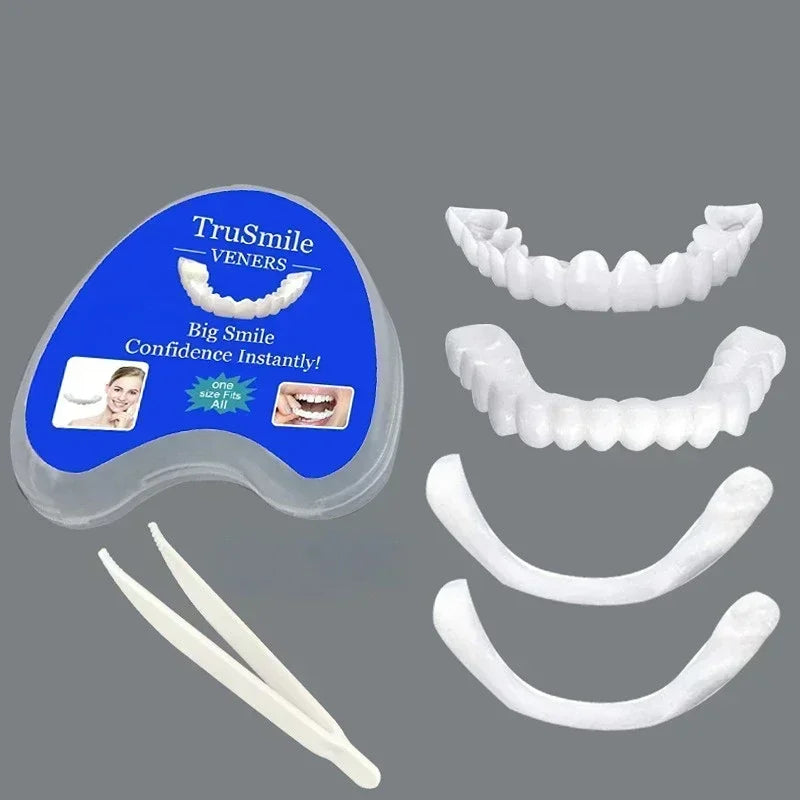 Snap-On Temporary Veneers for Instant Smile Whitening and Replacement
