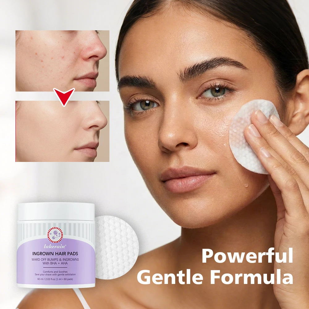 Exfoliating Ingrown Hair Treatment Pads for Razor Bumps
