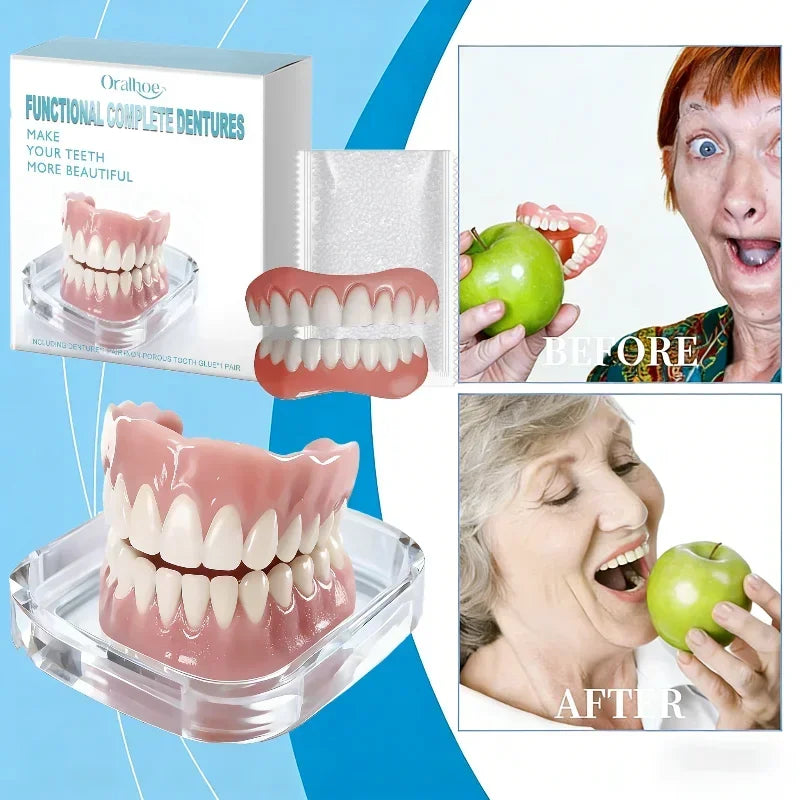Instant Cosmetic Smile Veneers for Upper and Lower Teeth