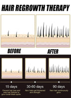Fast-Acting Hair Growth Scalp Treatment Serum