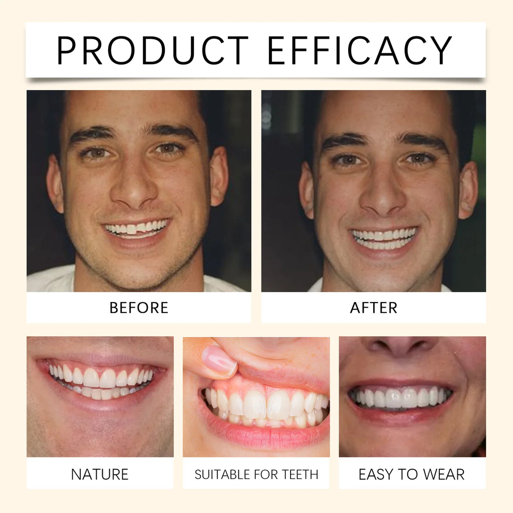 Temporary Silicone Cosmetic Dentures for Missing Teeth