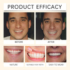 Temporary Silicone Cosmetic Dentures for Missing Teeth