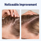 2% Deoxyribose Scalp & Hairline Strengthening Serum