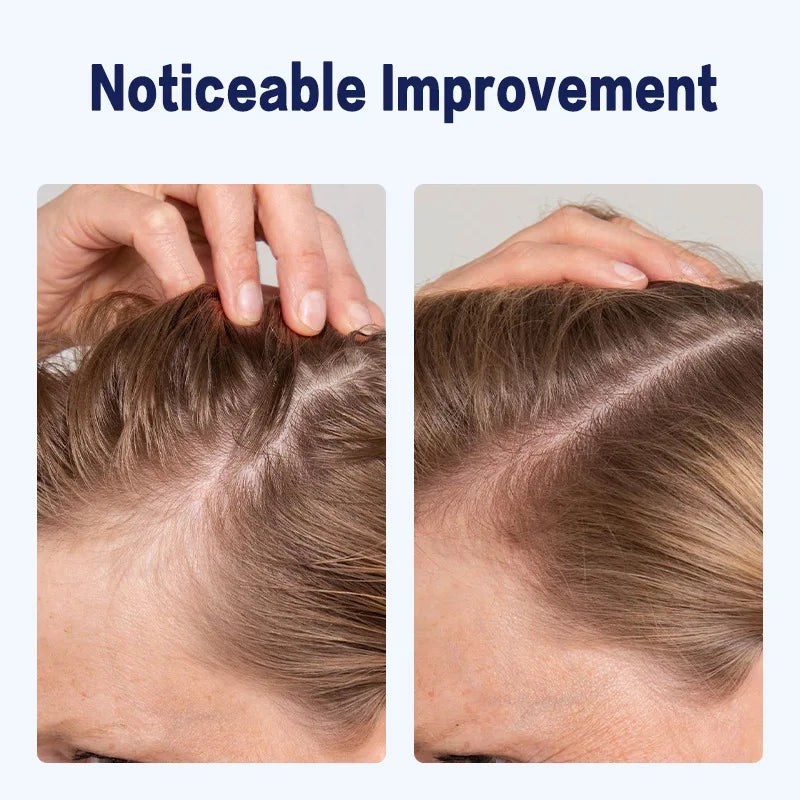2% Deoxyribose Scalp & Hairline Strengthening Serum